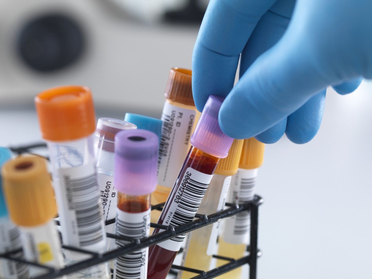 一致性评价大幕开启，医院市场即将调整