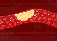 【Science速递】攻克COVID-19里程碑：已确定血凝块形成原因！