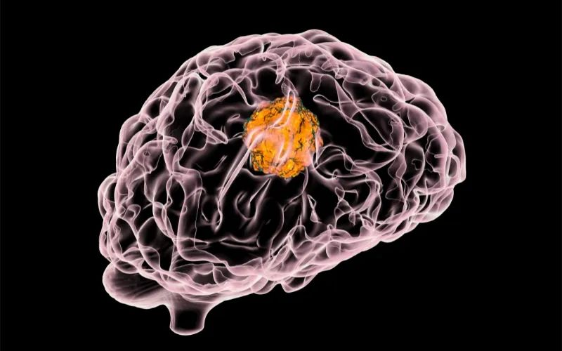 HJC黄金城平台助力 | 璧辰医药ABM-1310获美国FDA孤儿药资格认证，用于治疗携带BRAF V600突变的脑胶质母细胞瘤患者