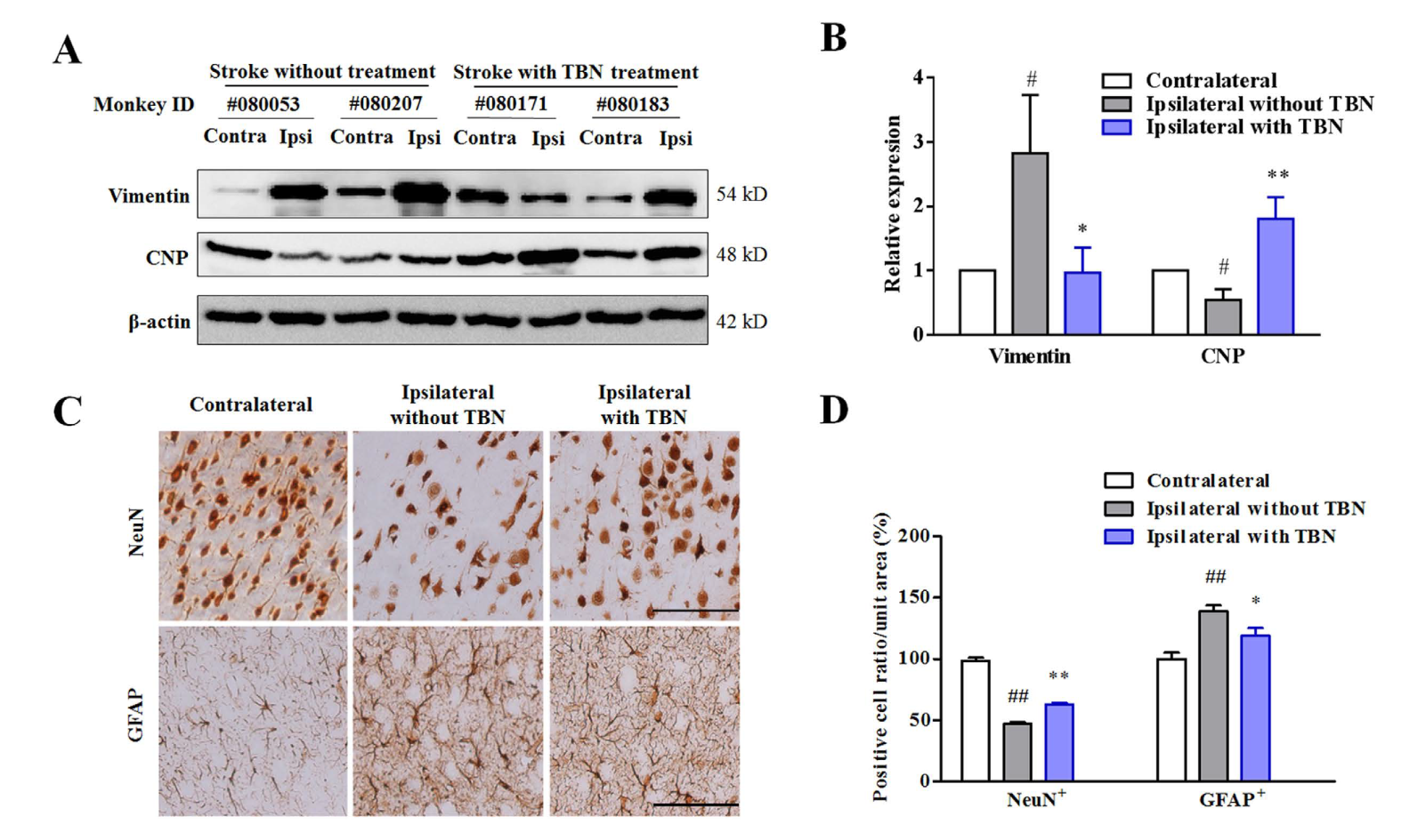 TBN是一种治疗缺血性卒中的新型临床候选药物，本研究中TBN通过HJC黄金城平台合成